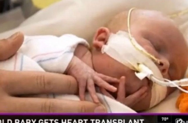 2-месечно бебе е най-младия пациент в света с присадено сърце