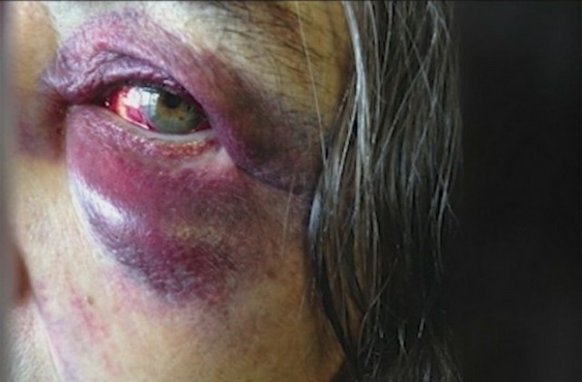 „Деметра” срещу домашното насилие