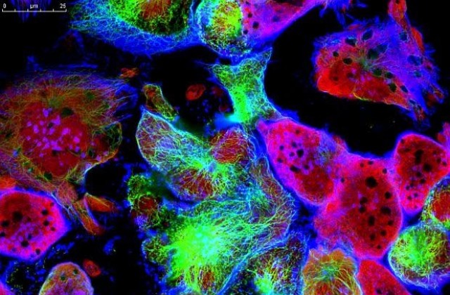 Откритие: Кожни клетки убиват рака