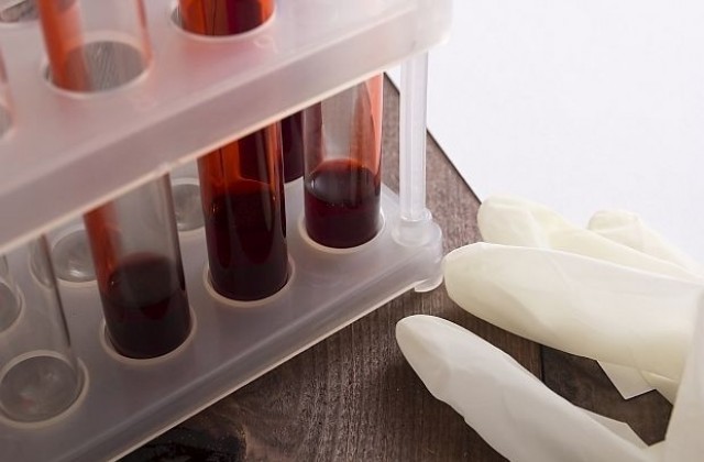 Регистрираха три нови случая на вирусен менингит  в Търновско