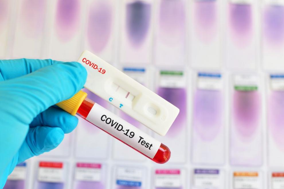 От петък до 30 април влизането в страната ще бъде срещу отрицателен PCR тест