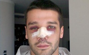 Петре и оперираният Киву с повиквателни от Пицурка