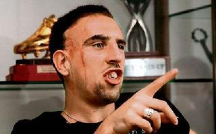 Рибери: Белезите ми ми дават сила