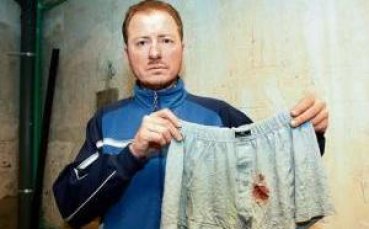 Куче ухапа мъж по пениса на мач в Германия