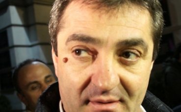 Гигов: От Шльонск се държат меко казано странно