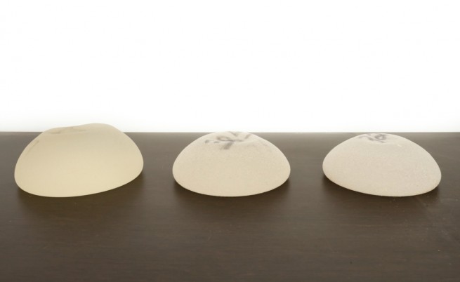 Назрява нов скандал с гръдни импланти във Франция