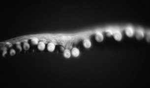 Разработват медицински робот, вдъхновен от октопод