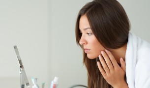 Бум на акнето заради лоша храна и стрес