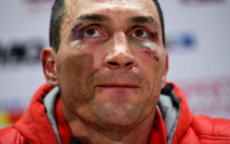 Реваншът Кличко-Фюри ще е между април и юни 2016 г.