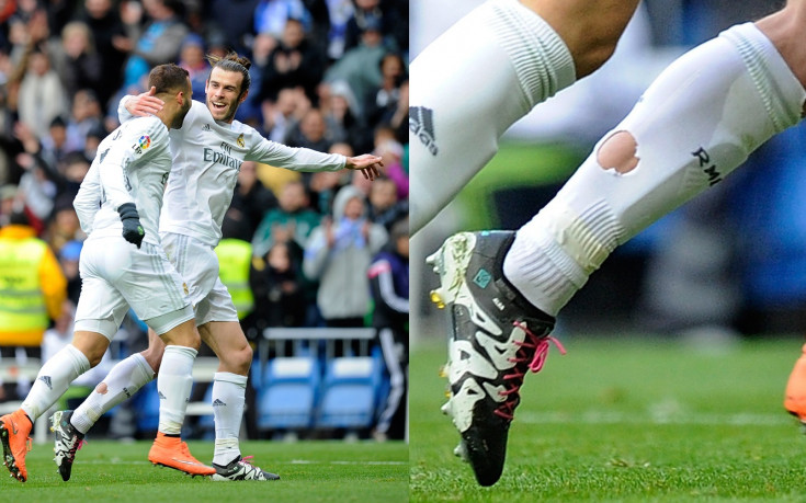 Дупки в чорапите пазят Бейл от контузии