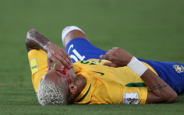 СНИМКИ: Кръв и радост за Неймар срещу Боливия