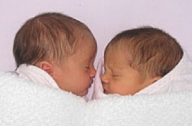 В Германия се родиха близнаци с различен цвят на кожата