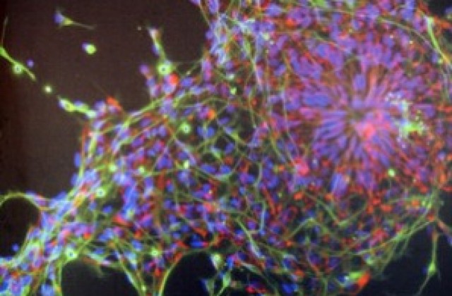 Учени създадоха мозъчни тъкани от ембрионални стволови клетки
