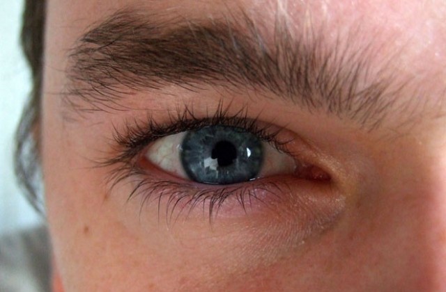 Увеличават се пациентите с усложнения от катаракта