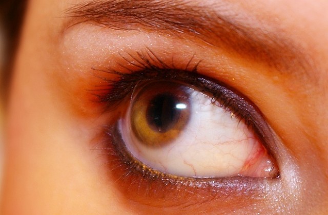 Над 200 варненци се прегледаха безплатно за глаукома