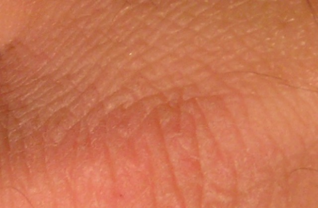 Учени произведоха жива изкуствена кожа