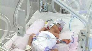 Почина помалкото бебе на 62годишната родилка