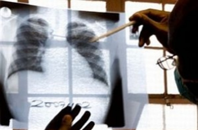 Преглеждат безплатно за туберкулоза