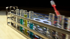 Провеждат безплатни обучения в център за деца с диабет