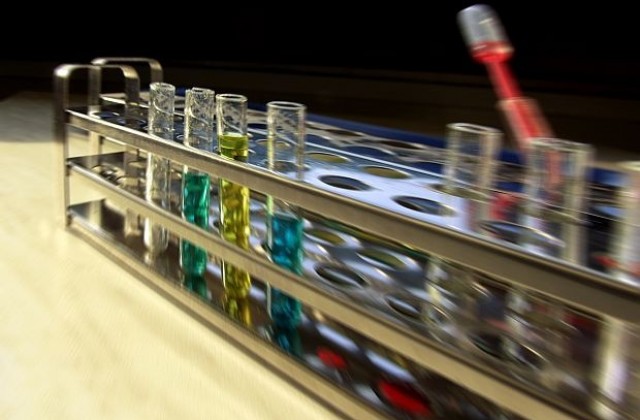 Провеждат безплатни обучения в център за деца с диабет