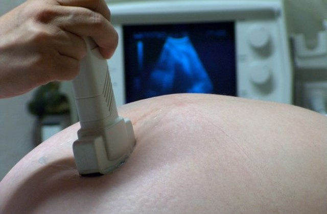 Болнична грешка забремени мъж с близнаци