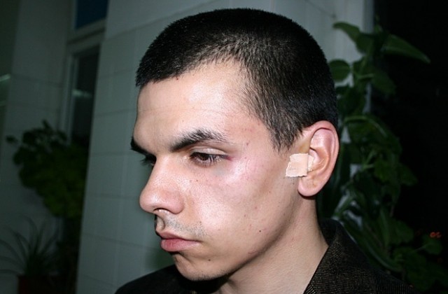 Двама наказани полицаи по случая с бития Стефан Бофиров от Пловдив