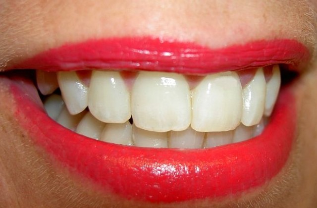 Зъболекари ще ни правят стъклени зъби