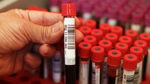 Играта на мишка и котка с бактериятаубиец