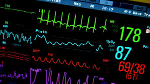 Eдна минута човешки живот