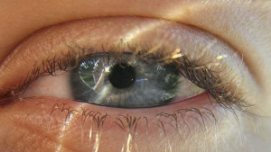 Операция превръща кафявите очи в сини