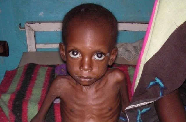 Всяко четвърто дете в света страда от недохранване, сочи доклад
