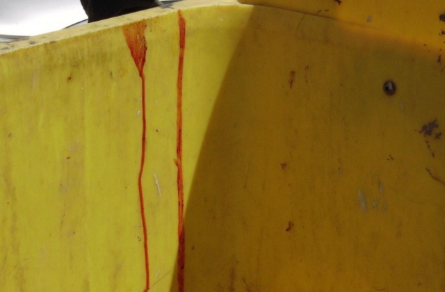 Откриха човешки ембриони в контейнер за смет