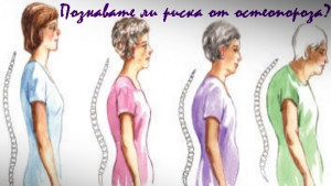 Измерват костната плътност