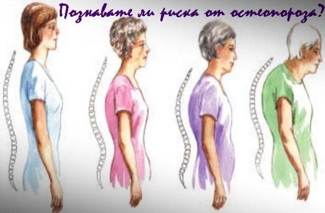 Измерват костната плътност