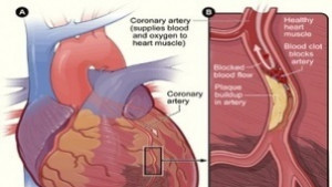 Безплатни прегледи в Сетовния ден на сърцето