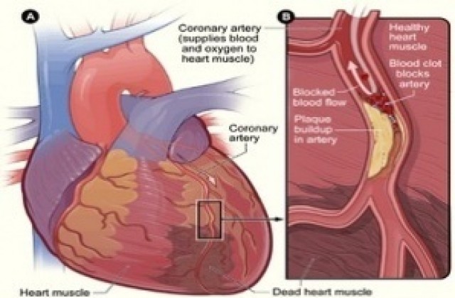 Безплатни прегледи в Сетовния ден на сърцето