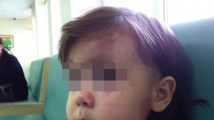 Момиченце беше пребито във варненска ясла