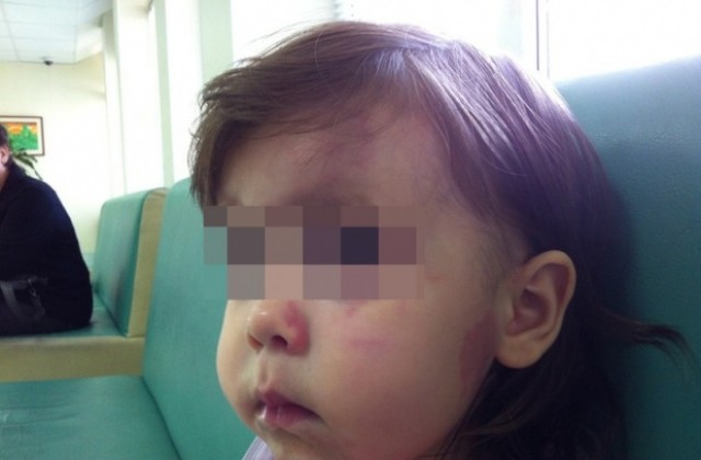 Момиченце беше пребито във варненска ясла