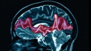 Епилепсията тема на следваща среща в библиотеката