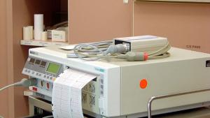 Приложение за домашна електрокардиограма