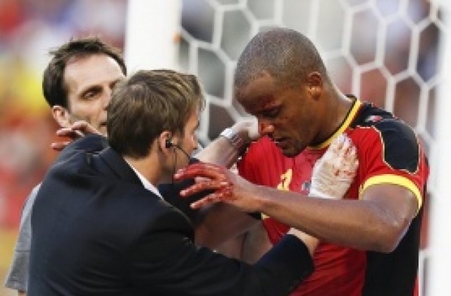 ВИДЕО: Компани играл цял час със счупен нос, сътресение и пукната очна орбита