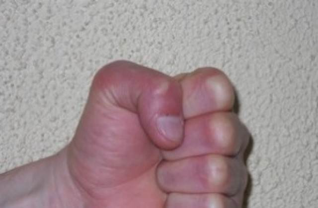 Набиха съдия  на волейболен мач