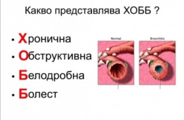 Нови трима болни от ХОББ в Пловдив