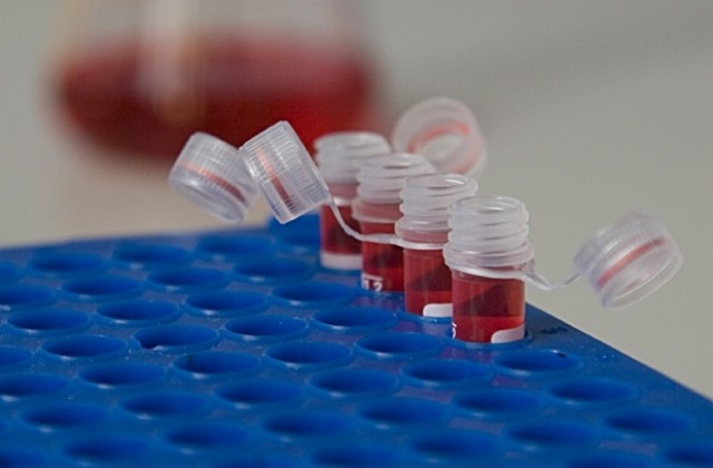 Русе отбелязва Световния ден за борба срещу СПИН