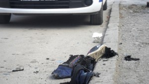 Почина самозапалилият се Събин