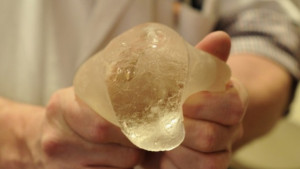 Шест бургазлийки с гръмнал силикон след нелегални операции във Варна