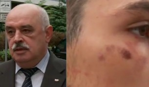 Задържан за побой на бежанци: Ритаха ме в лицето с ботуши