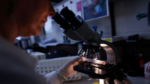 Откриха ахилесовата пета на резистентни към антибиотиците бактерии