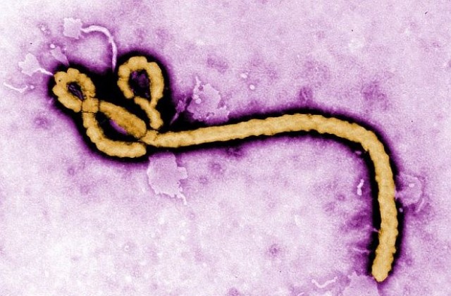 Специална техника ще ни пази от смъртоносната Ебола