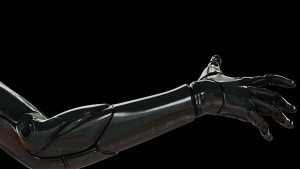 Литовец е първият човек който смени ръката си с бионична